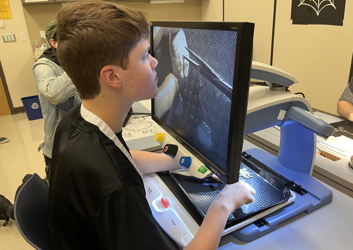 An adolescent digs into and examines a cow eye magnified under CCTV.